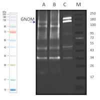 GN | Gnom in the group Antibodies for Plant/Algal / Developmental Biology / Signal transduction at Agrisera AB (Antibodies for research) (AS16 3980)